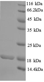 SDS-PAGE