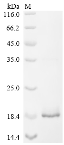 SDS-PAGE