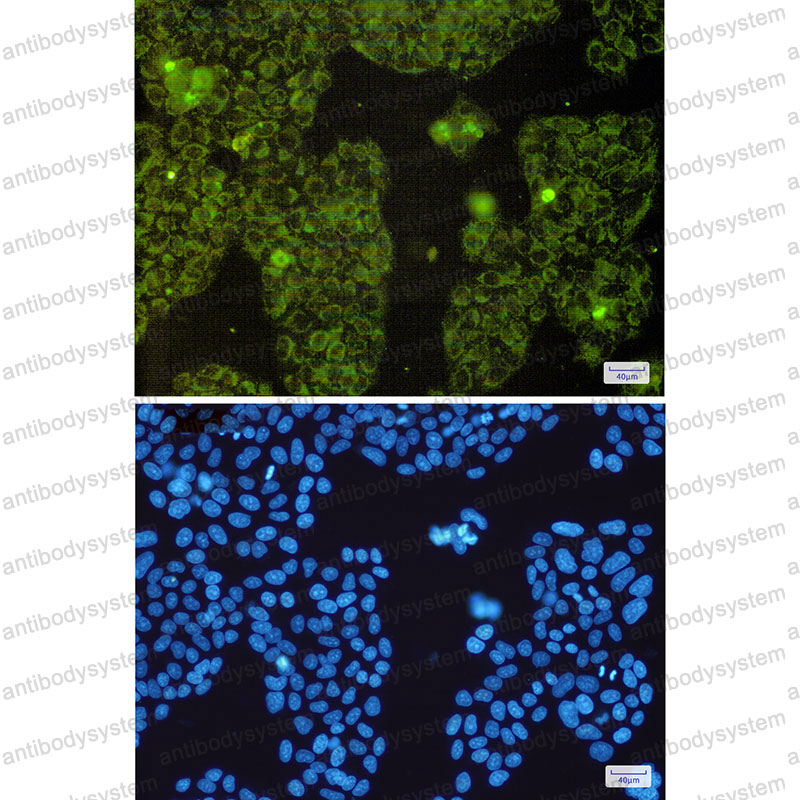 Валидация IF - AntibodySystem RHB85701