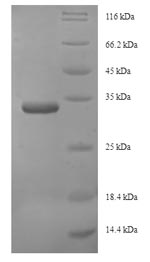 SDS-PAGE