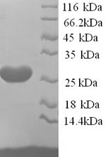 SDS-PAGE