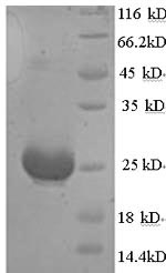 SDS-PAGE