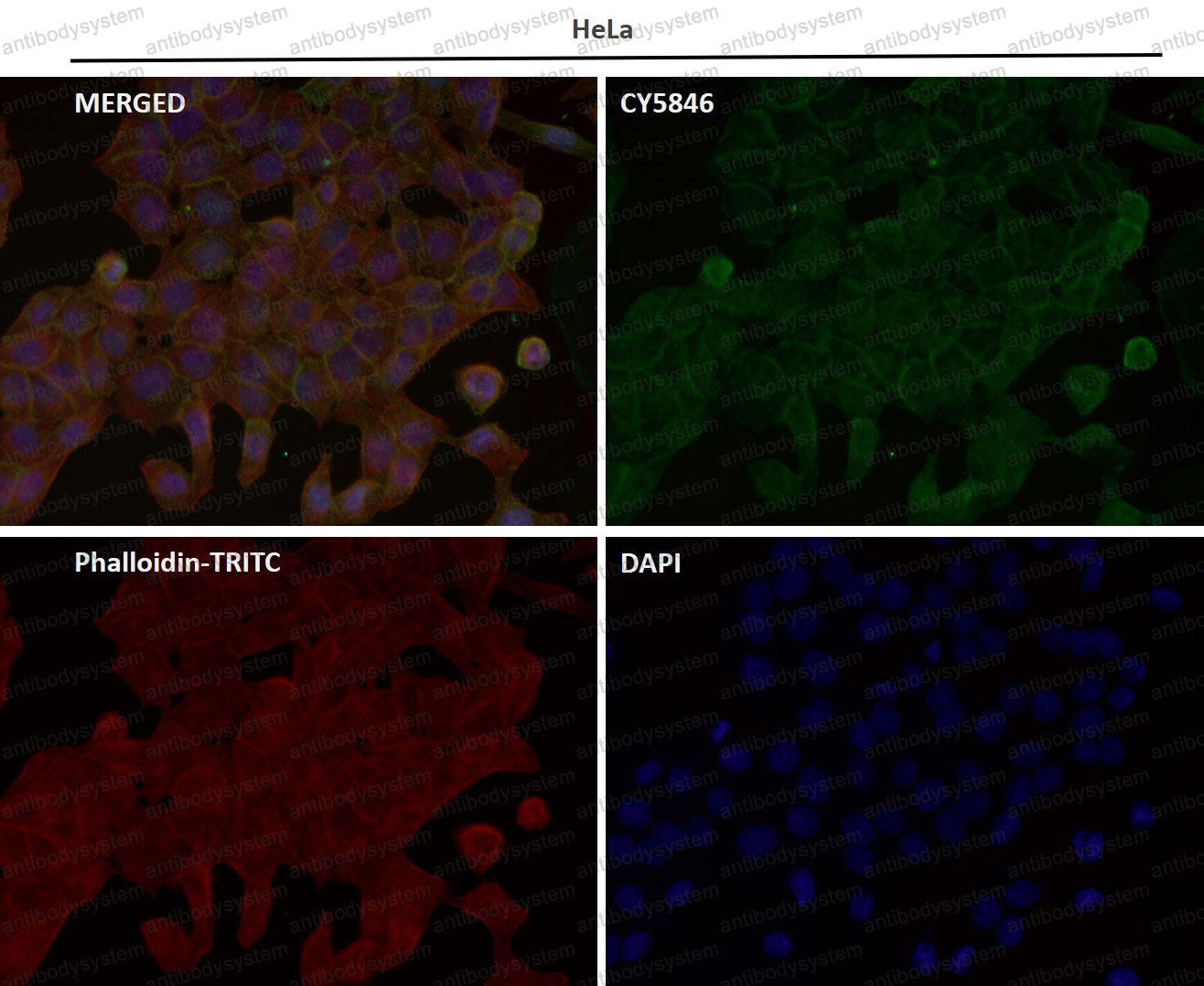 Валидация AntibodySystem RHC82429