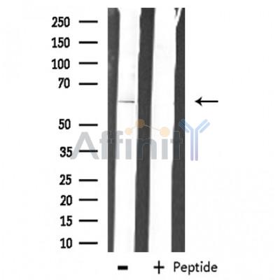 Валидация Affinity DF3100 - 13856
