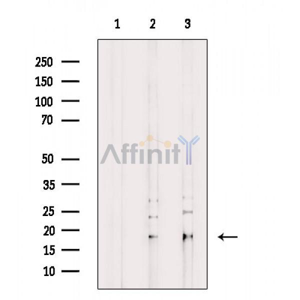 Валидация Affinity AF9118 - 4902