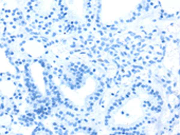 Валидация AssayVector ARM1844(2427)