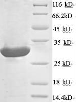 SDS-PAGE