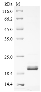 SDS-PAGE