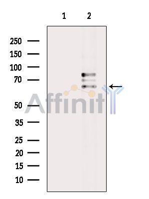 Валидация Affinity DF8987 - 21185