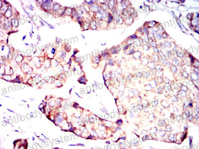 Валидация AntibodySystem RHG06501 (2817)