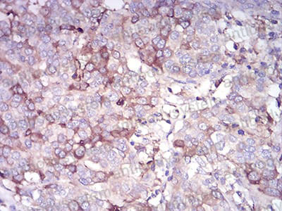 Валидация AntibodySystem RHF12003