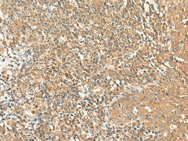 Иммуногистохимия, GRIPAP1, ткань миндалин человека
