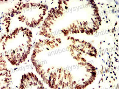 Валидация AntibodySystem RHD15011 (1363)