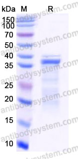 EHB04301, SDS-PAGE
