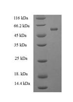 SDS-PAGE
