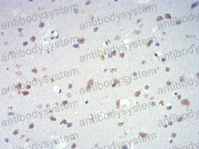 Валидация AntibodySystem RHJ19801 (3352)