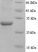 SDS-PAGE