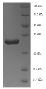 SDS-PAGE