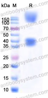 EHD61401, SDS-PAGE