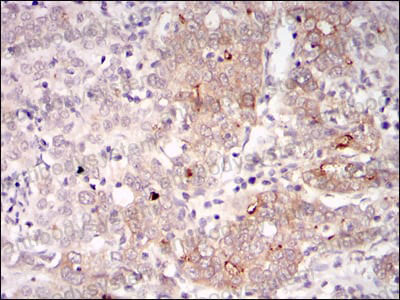 Валидация AntibodySystem RHJ29702