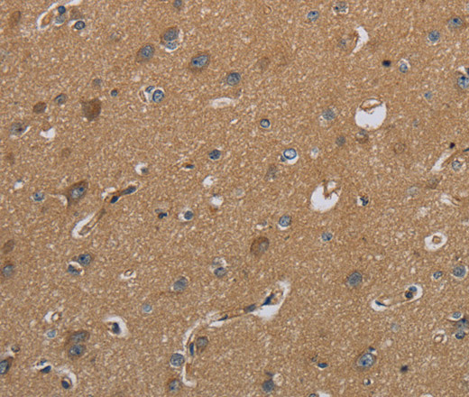 Валидация Elabscience E-AB-15102