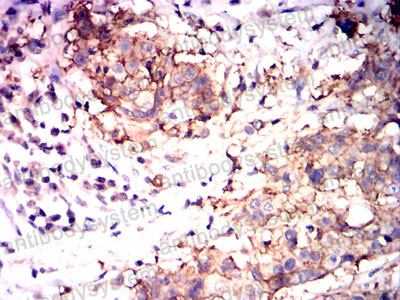 Валидация AntibodySystem RHJ53501 (3460)