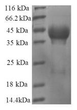 SDS-PAGE