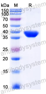 EHC40701, SDS-PAGE