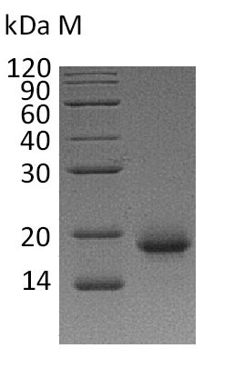 SDS-PAGE