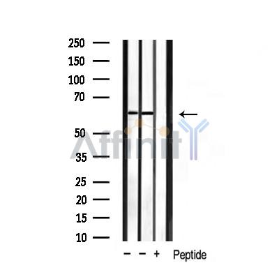 Валидация Affinity AF6470 - 3797