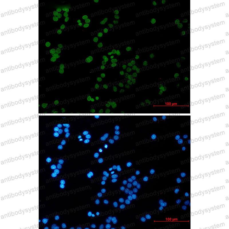 Валидация IF - AntibodySystem RHN89501