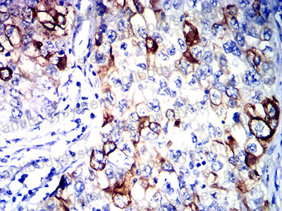 Валидация AntibodySystem RHE23502 (2045)