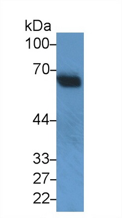 58218