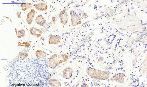 Иммуногистохимия, JAK3, ткань желудка человека