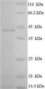 SDS-PAGE