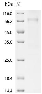 SDS-PAGE