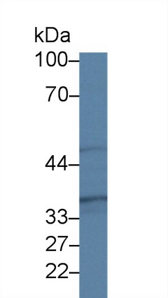 14311