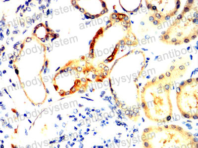 Валидация AntibodySystem RHD40501 (1562)