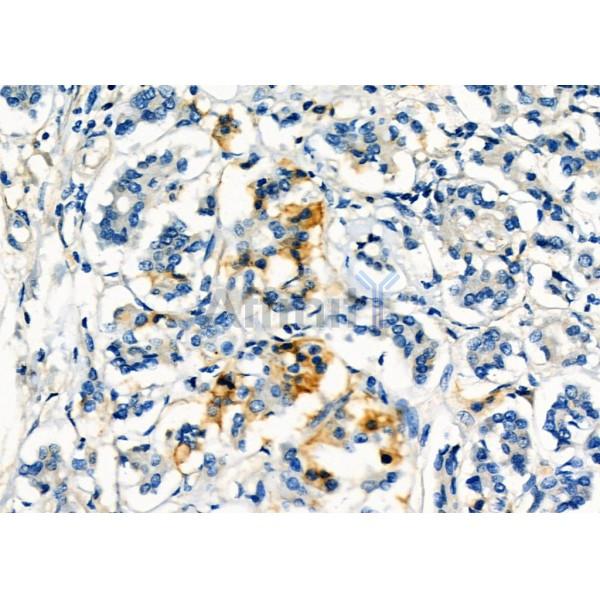 Валидация Affinity DF6762 - 18326