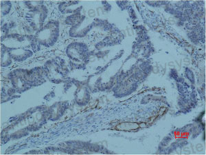 Валидация AntibodySystem RHA51403