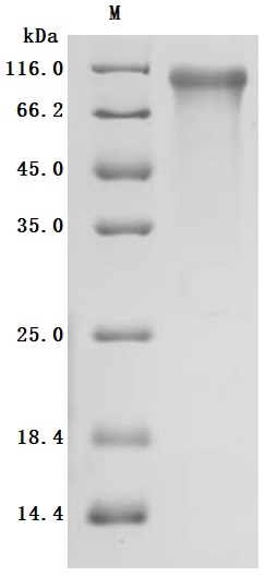 SDS-PAGE