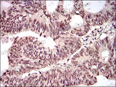 Валидация AntibodySystem RHN91501