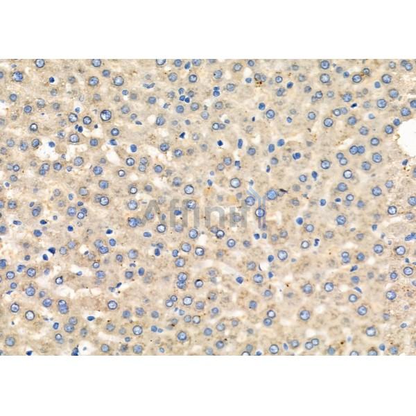 Валидация Affinity DF9536 - 22188