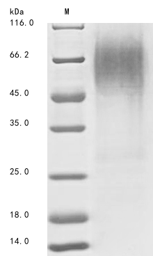 SDS-PAGE