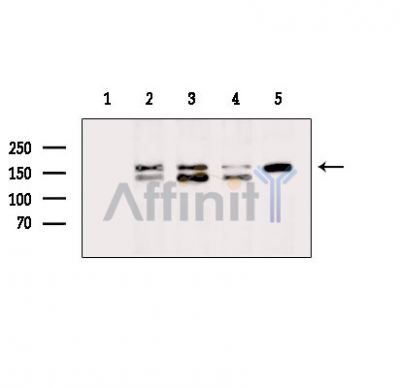 Валидация Affinity DF14258 - 10111