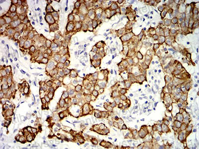 Валидация AntibodySystem RHC36007 (968)