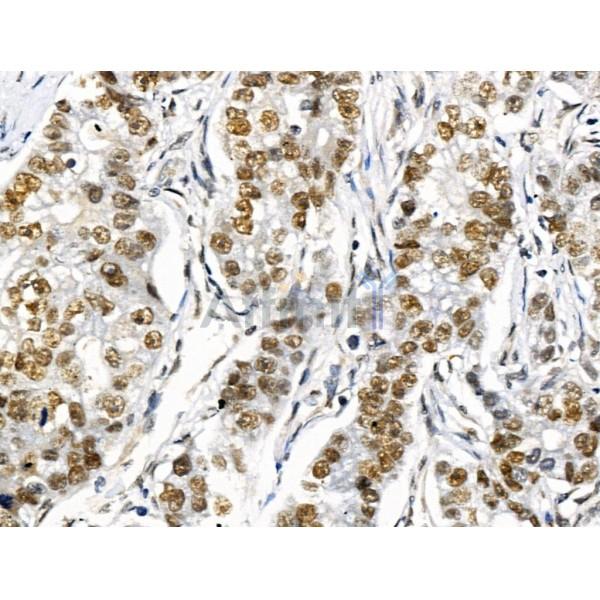 Валидация Affinity DF3363 - 14236