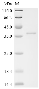 SDS-PAGE