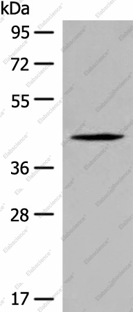 Вестерн-блоттинг, QTRT1, клетки Jurkat