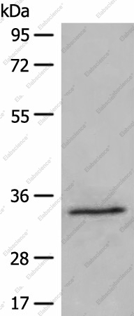 Вестерн-блоттинг, DIMT1, клетки 231